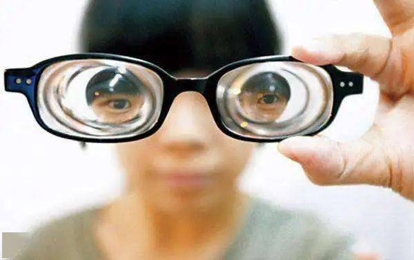 ②有些低度近视患者也感觉自己眼球变形,那是因为