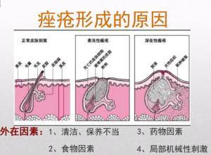 坚持这8个事项,还您光彩夺目容貌!