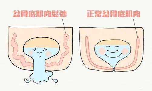 做个产后康复怎么了!说好的男女平等呢?