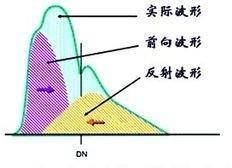 测量动脉血压的原理是什么_肱动脉测量血压图片(2)