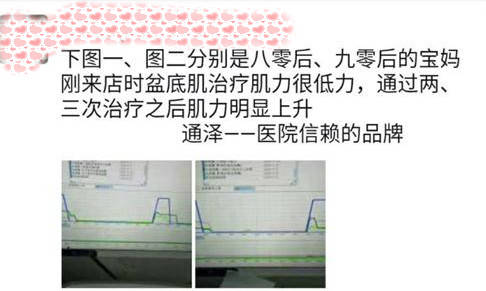 老总治疗仪_强弓治疗仪使用演示图