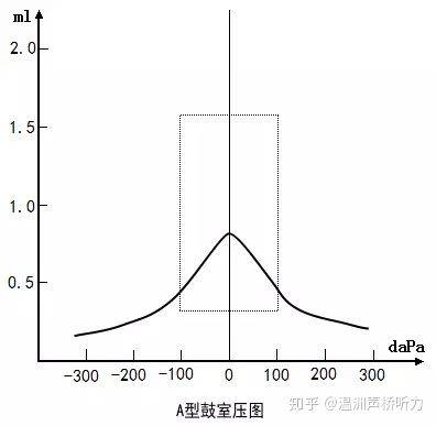 鼓室导抗图分型成人中耳以劲度作用为主,采用低频探测音(226hz)测试