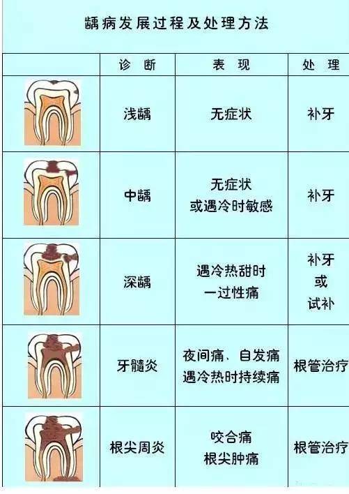 筷子竟能判断是否需要根管治疗?