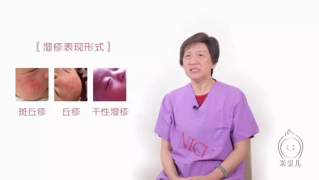 宝宝■新手爸妈要这样做！宝宝湿疹难缠