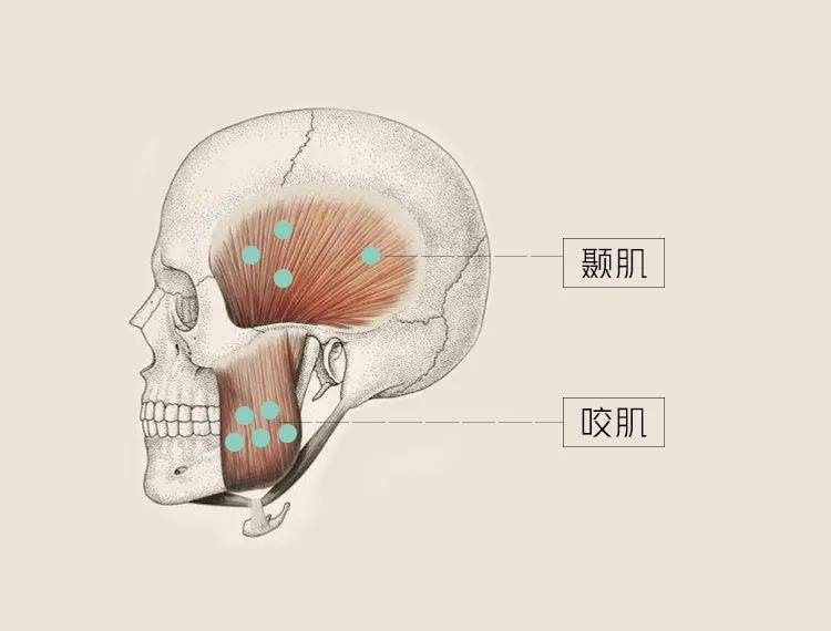 咬肌和瘦脸注射法一样