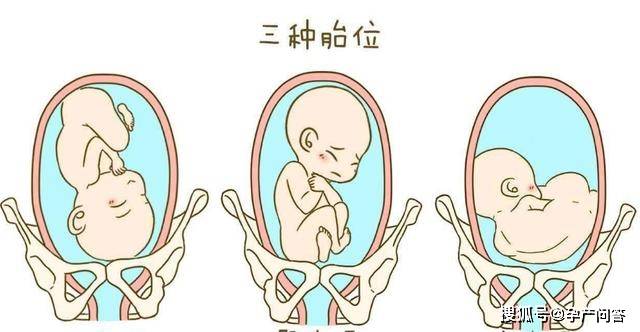 孕期，怎样看懂胎位数据，早了解，早纠正(附胎位数据对照表)