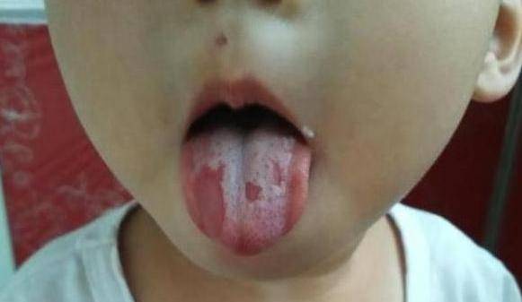 大意|别大意,别让无知害了宝宝这6症状表示孩子已经严重积食