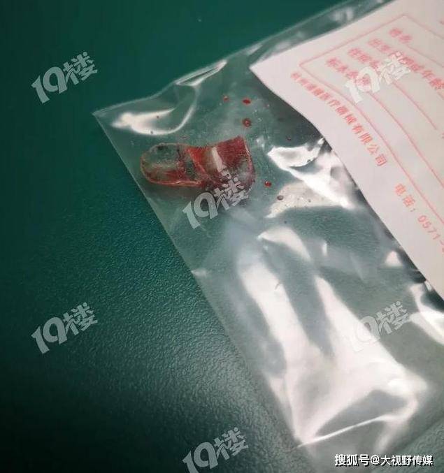 小时|整整手术7小时才取出！这东西几乎家家都有杭州一孩子吞食异物271个小时