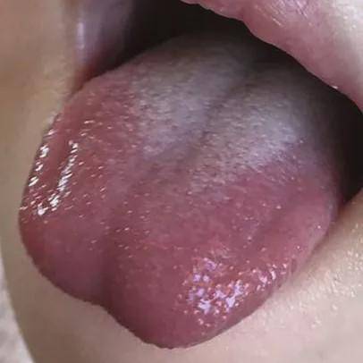 食物|刚吃完又喊饿，可能是胃强脾弱哦捏积派——孩子总是吃不饱