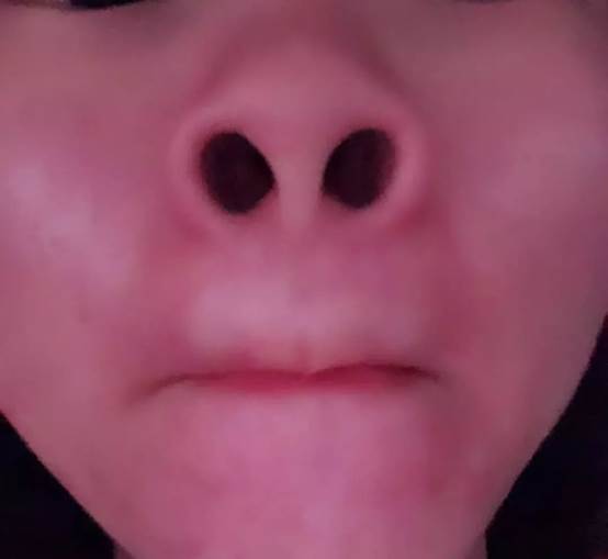 宝宝|不仅毁颜值，还可能伤身体孩子怎么那么爱挖鼻孔？长期挖鼻孔