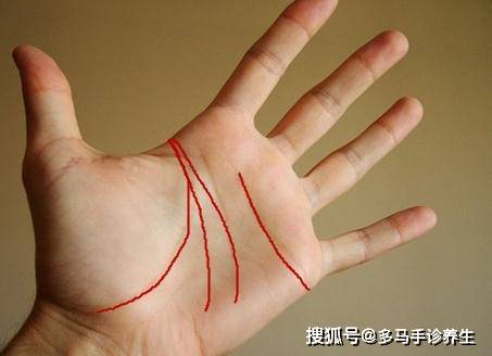 双生命线是什么 e608cef7fd364678ac6dab08cac07286.jpeg