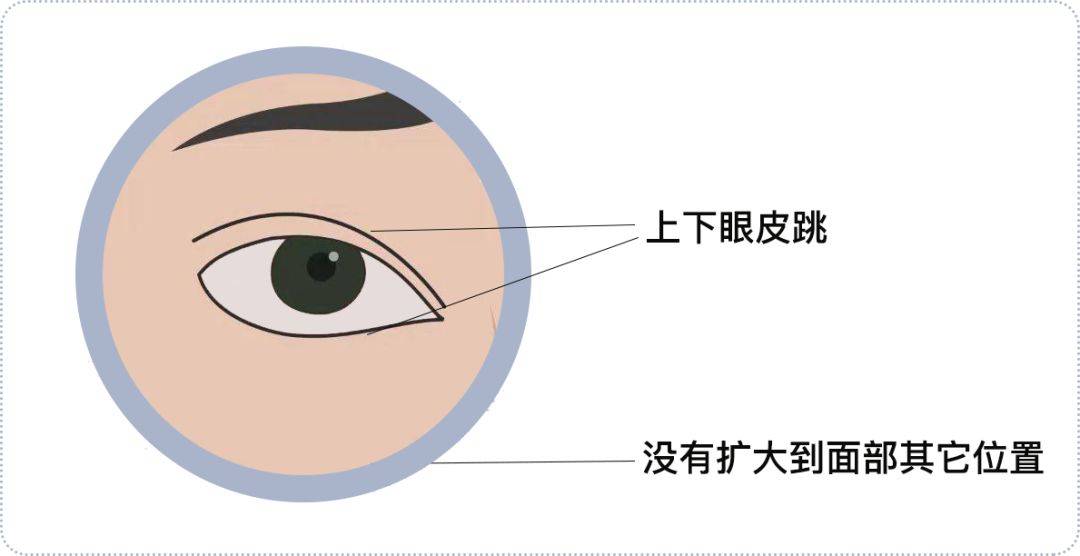 狐大医 | 关节响,打嗝,眼皮跳,这些小毛病是疾病的先兆吗?_手机搜狐网