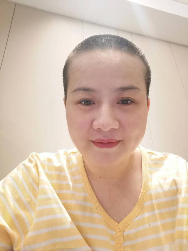 郑敏剃光头准备做手术，德云社集体送祝福，岳