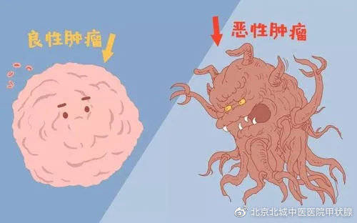 怎么治疗可以消灭肿瘤?