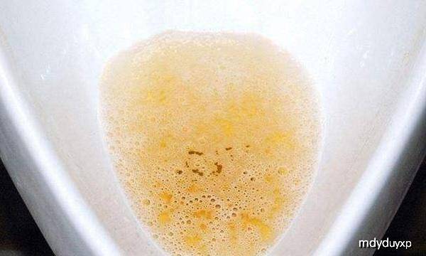 吃什么药会导致小便泡沫 48c6fb33b72d419d874d2a9c352549ea.jpeg