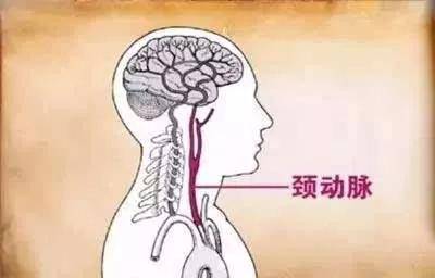 一,颈动脉窦医学上经常可以看到,如一对男女抱住狂吻,结果女子被搂抱