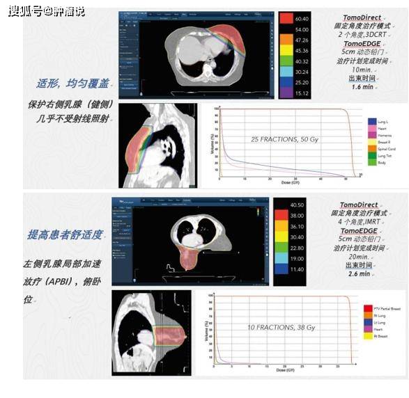 乳腺癌放疗该要注意哪些问题怎么做