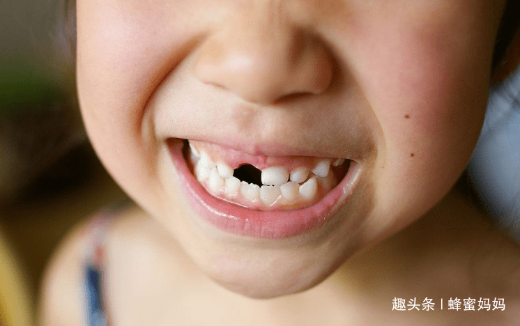 乳牙|重要时刻能“救命”？没这么简单宝宝“乳牙”掉了先别扔
