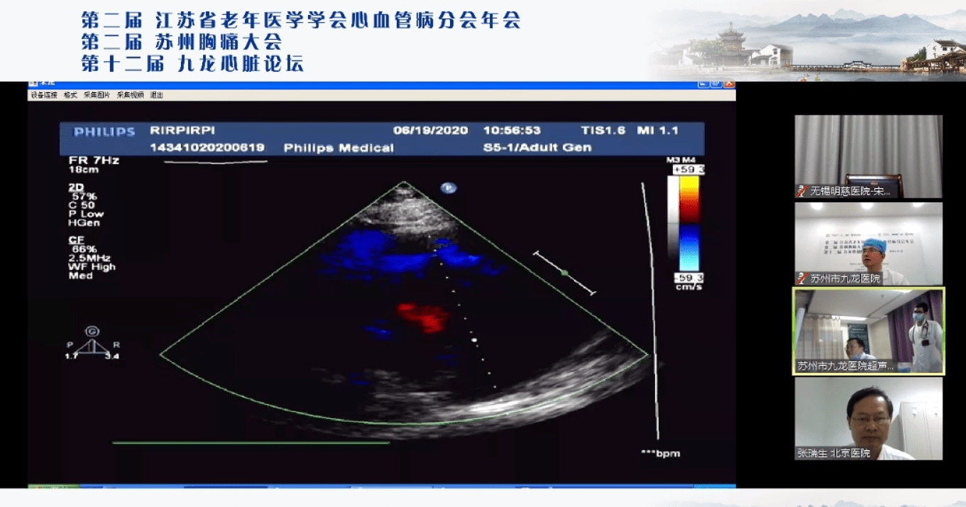 线上|亮点|苏州九龙医院柳标和北京医院张瑞生共同发起“远程交互式会诊直播”
