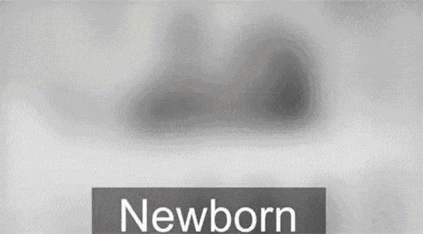 右眼|4岁才发现！4大眼部检查1个也别漏！1遮2看3不能宝宝右眼失明