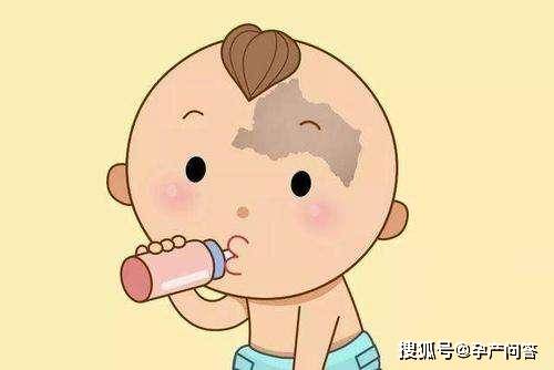 行为|早避开，以免胎儿自卑胎记是怎么形成的？孕期3种行为易造成