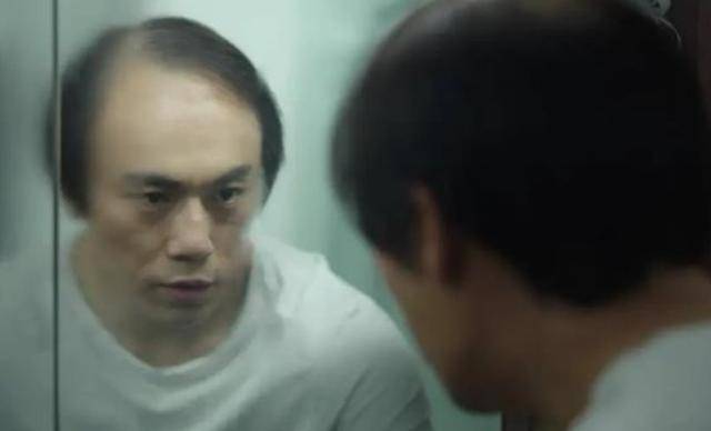 张东升秃顶造型深入人心,秦昊晒秃头内幕,真是笑坏网友