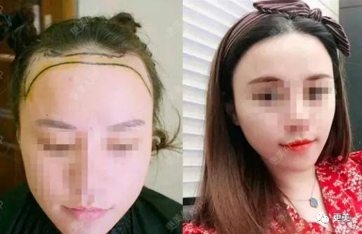 在线|发量王者鞠婧祎在线教你换头！2.5亿脱发少女有救了！