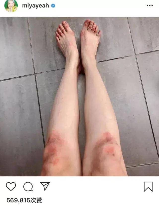 宣美|李宣美回归被质疑隆胸！不输泫雅的“南韩腿精”也要被杠？