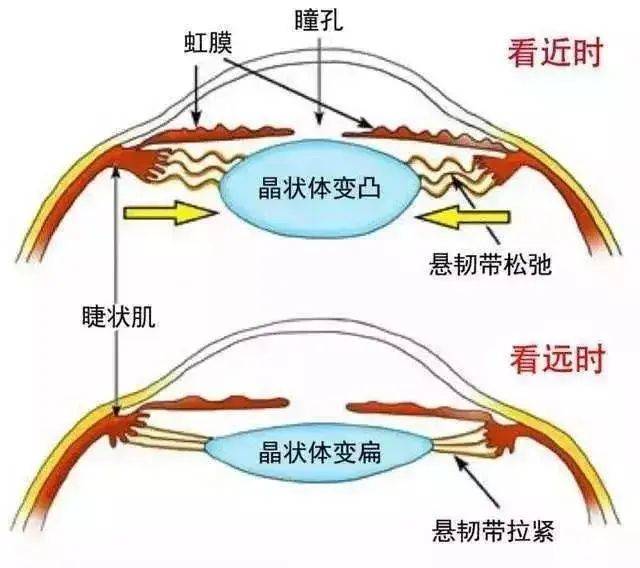 看近处会动用我们的调节(睫状肌收缩→悬韧带松弛→晶状体变凸→屈光