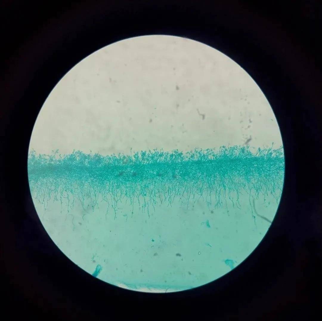 显微镜下的青霉菌,有没有被惊艳到?