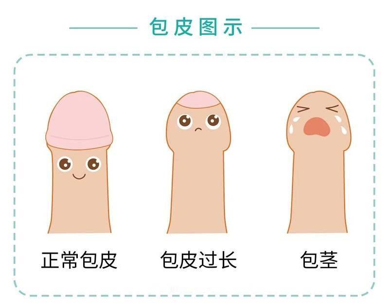 暑假,关注"小丁丁"那些事儿!_手机搜狐网