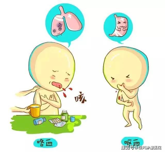 科普 关于消化道出血,你需要了解这些事