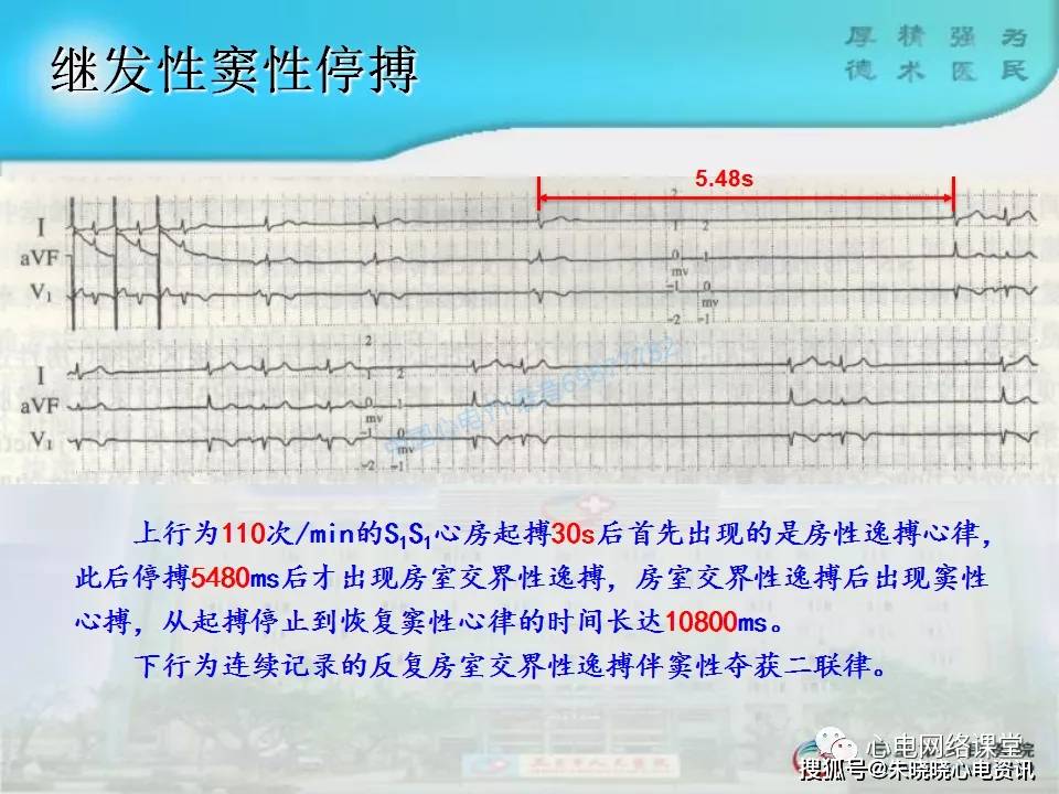 食管心脏电生理技术的临床应用