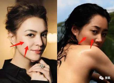 张脸|当年艳绝四方让张雨绮都甘心做配,可现在这张脸说崩就崩了...