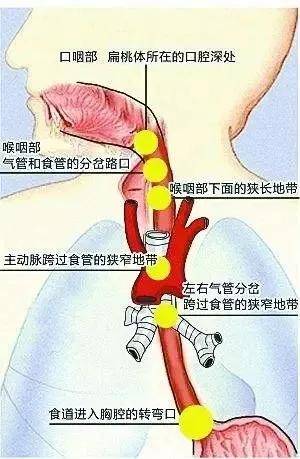 03. 胃穿孔