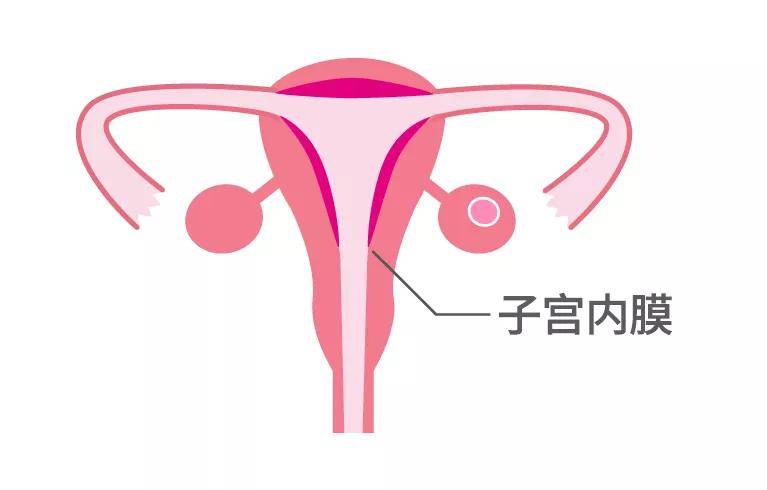 发现内膜薄、子宫内膜炎，教你避开这四个坑，养出完美内膜！