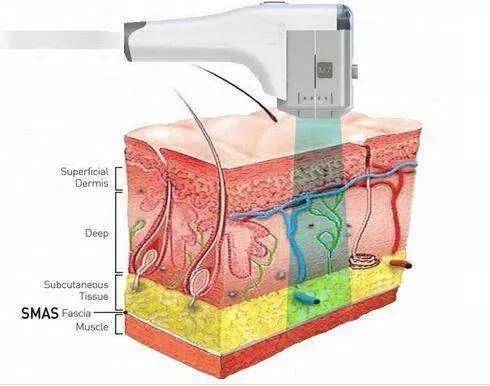 陈小春|陈小春管同龄人叫“奶奶”,这也太尴尬了吧!哈哈哈哈……