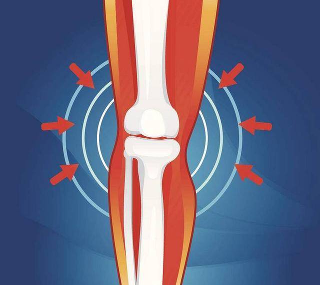 膝关节一动"咔咔响,中医张建福表示,要多警惕这六种情况