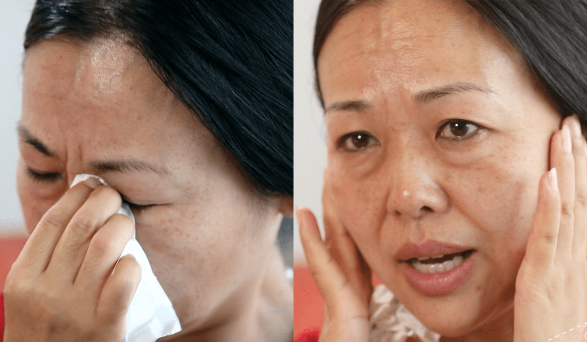 樊女士|四惠医美姚乃君主任速提美案例故事：女人打不垮，更要脸不垮