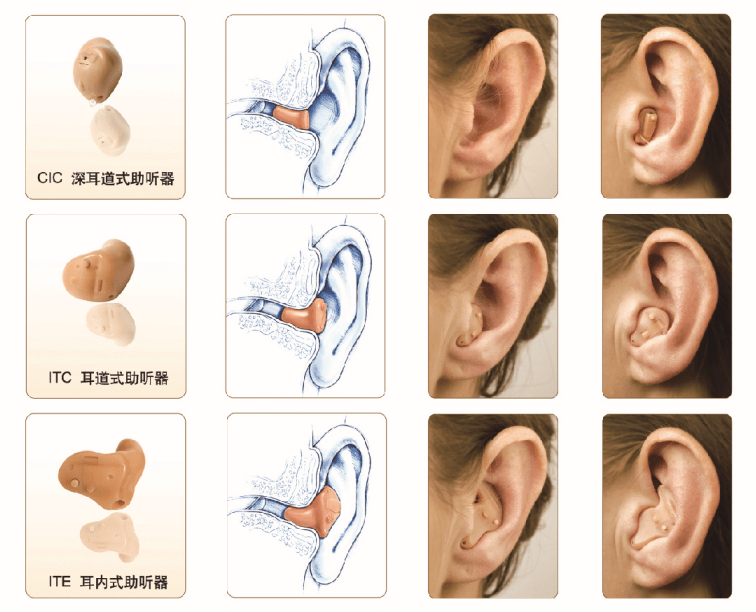 助听器有塞在耳朵里的,也有挂在耳朵外的,哪种好?
