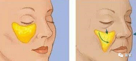 人中|20岁的脸垮得像40岁，还比关晓彤讨人喜欢，她真没不服气吗？