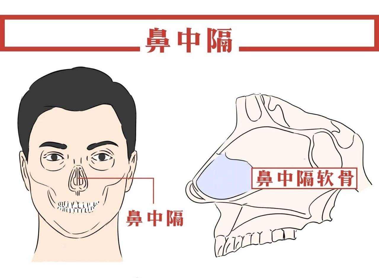 鼻中隔软骨整形有哪些好处?有什么危险或并发症吗?