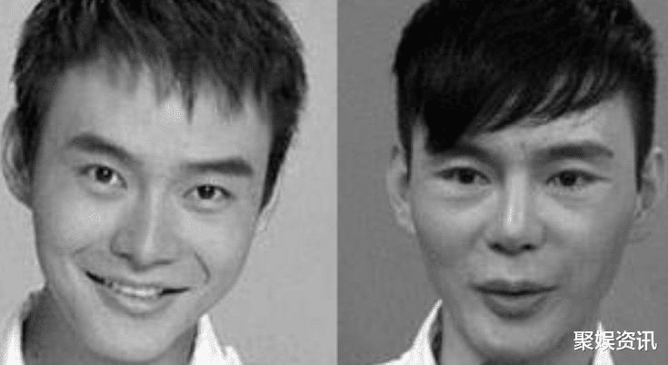 5位整容失败的明星,第3位差点毁容,最后一位整容成"巫婆"!