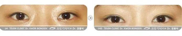 双眼皮|翻了100张照片，才发现她是贵圈换头最失败的女星