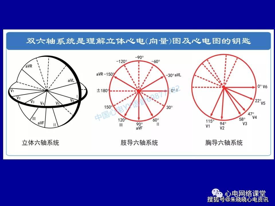 心电向量在鉴别诊断心电轴左偏中的优势