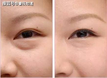 8a1bd4ab23c24e1c99d79629476bfe69.jpeg