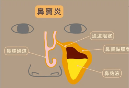 046ade48027a4186b60f6ed1415d33d8.png