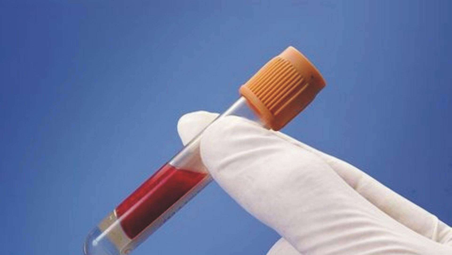 自发性|乙肝新药开发难点，需符合2项特殊条件，自发性血清转化可能吗？