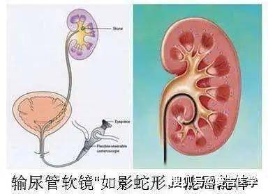 左下腹疼,有哪些常见的病因,该咋办?医生给您讲清楚