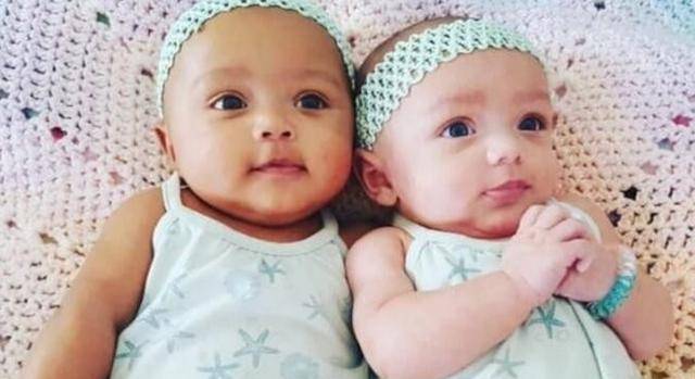 宝宝|丈夫怀疑不是亲生，原来是孕期吃了这几样东西双胞胎“奥利奥”